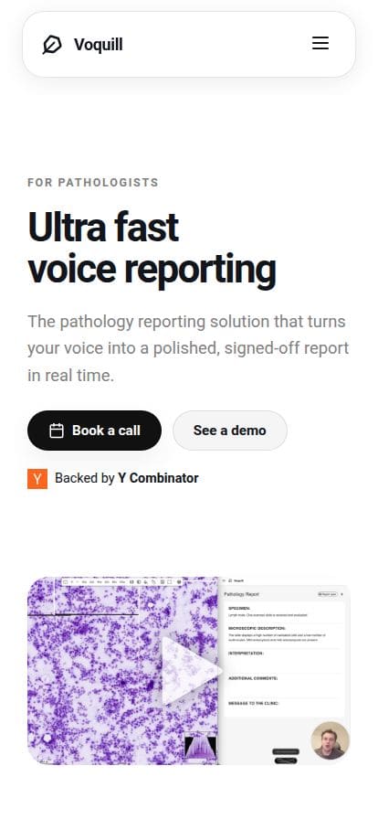Voquill スマホ表示